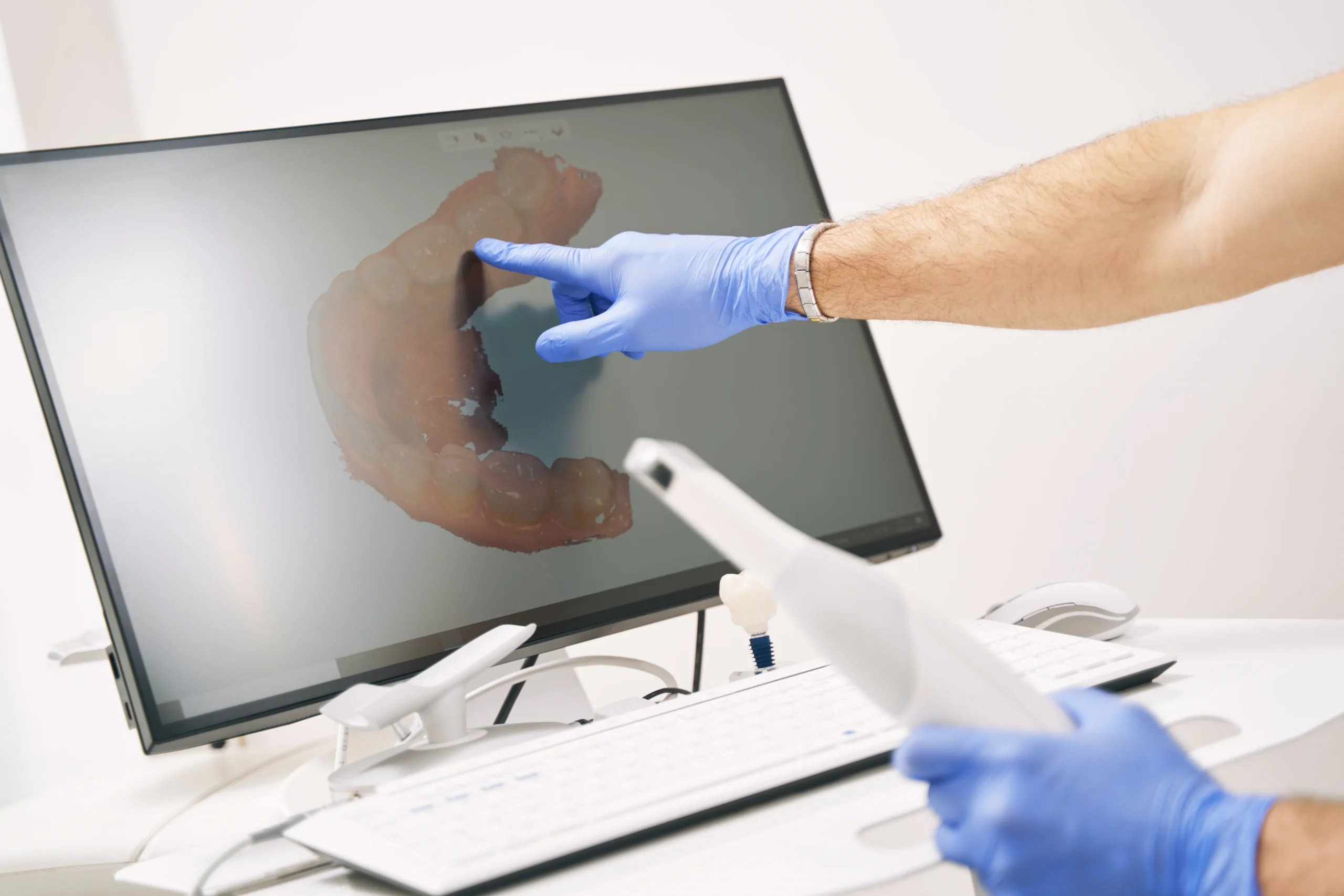 male-dentist-hand-pointing-at-computer-display-wit-2022-03-25-18-31-48-utc (1)